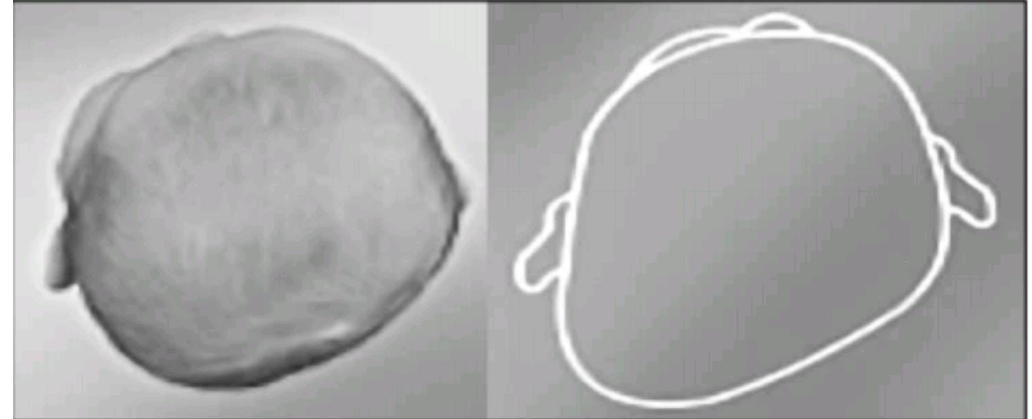 kraniyal kask